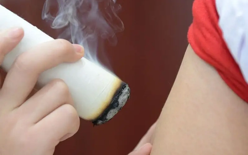 moxibustion therapy
