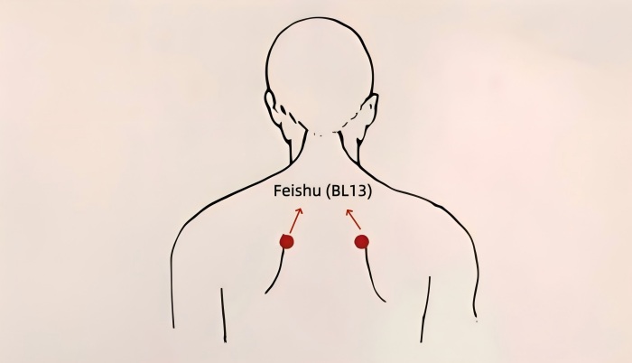 Cold and Flu Moxibustion Therapy: Feishu(BL13)