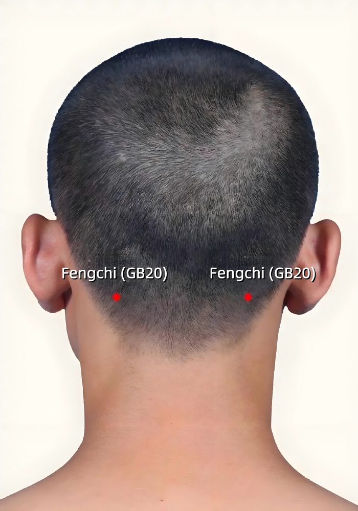 Cold and Flu Moxibustion Therapy: Fengchi (BG20)