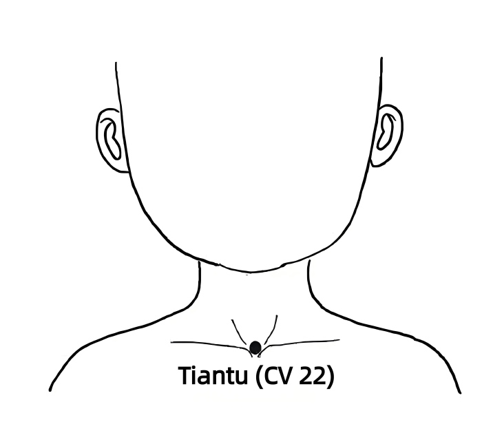 Tiantu(CV22)