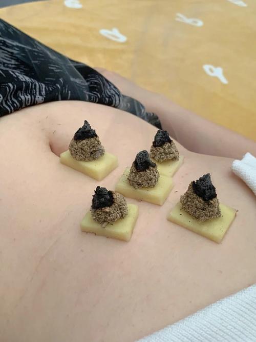 ginger moxibustion