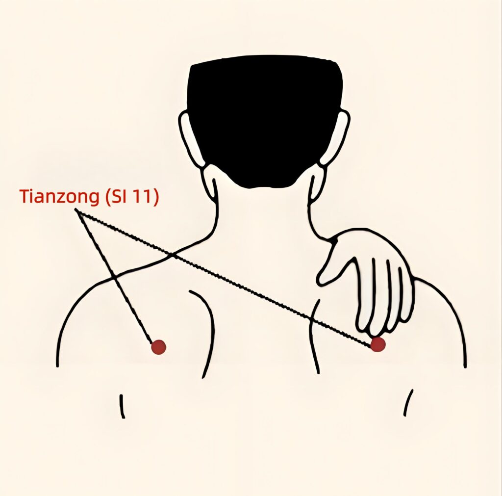 How to Do Moxibustion at Home for Shoulder Pain