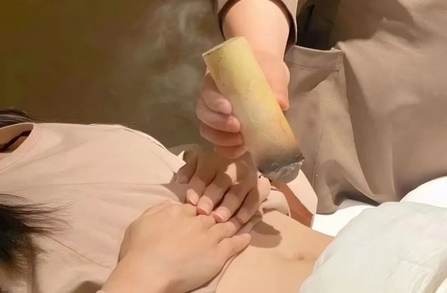 what to do after moxibustion
