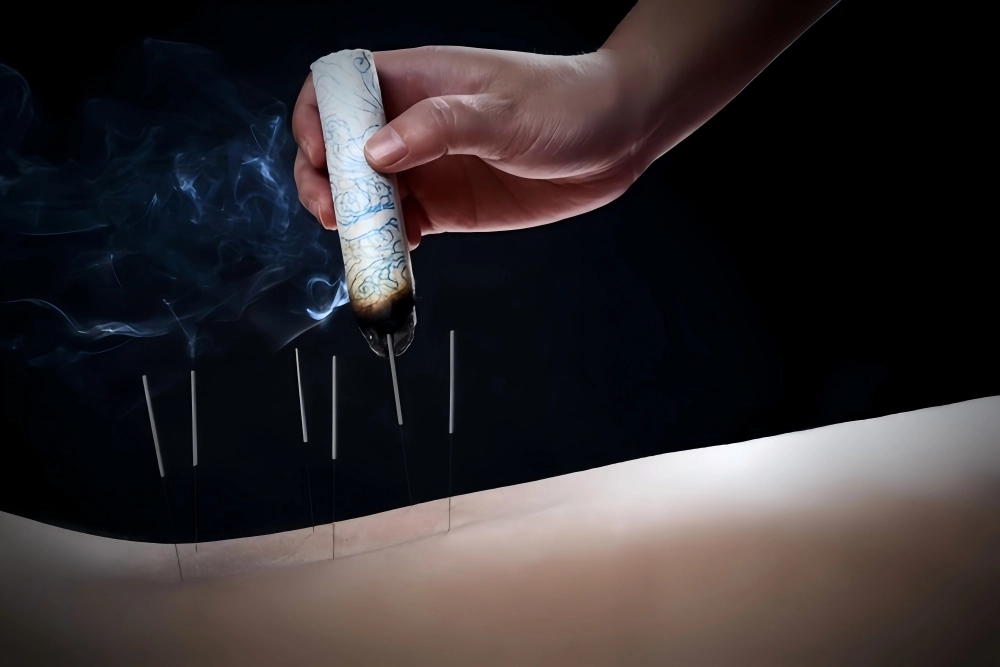 What Is Moxibustion Therapy